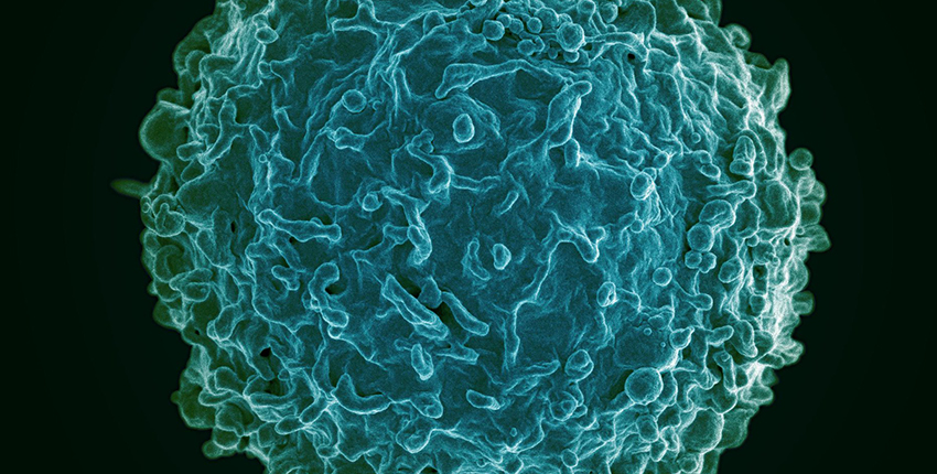 Image of a human B cell