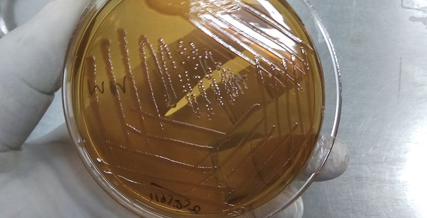 Morganella morganii bacteria on a plate. 